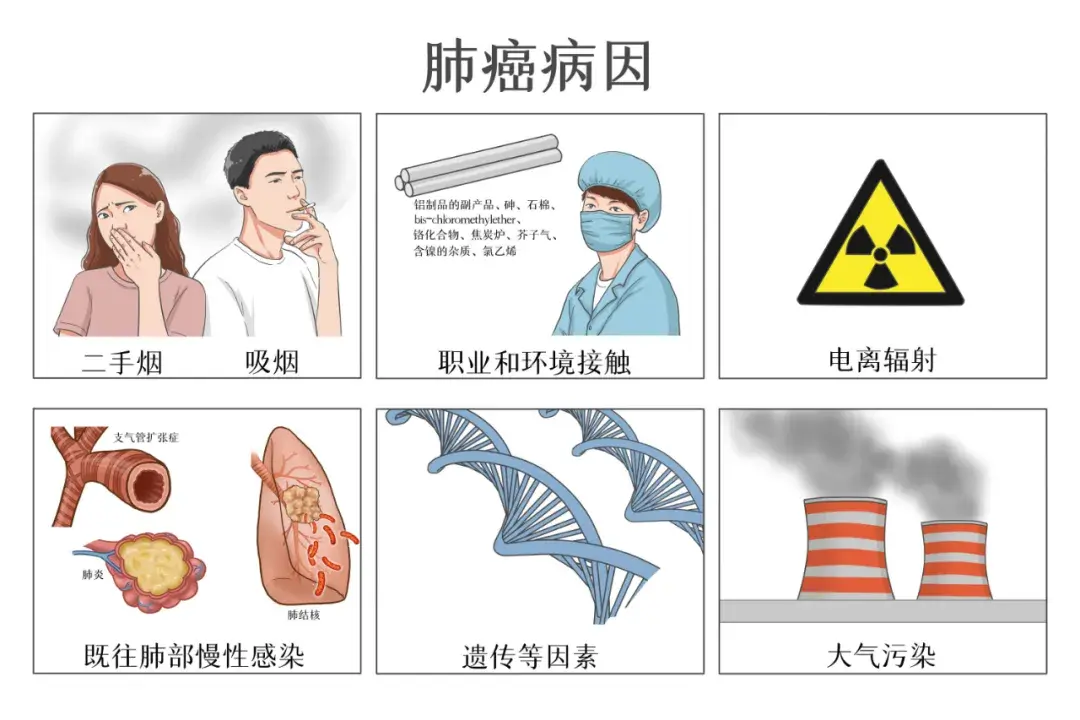 肺癌(肺癌中晚期一般寿命多少年)-第2张图片-鲸幼网