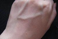 手背上的青筋很明显,是身体内有病吗?