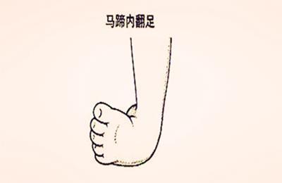 v2-c8a9b6c91d5fe5d071f8c0b598f7cfc4_1440w.jpg?source=172ae18b