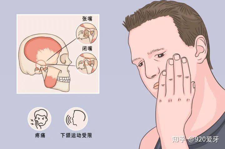 国内口腔颌面外科的发展究竟如何? - 知乎