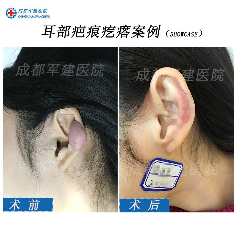 v2-c8cba1a9d1c9cb658b7de5829fe34bc4_1440w.jpg?source=172ae18b