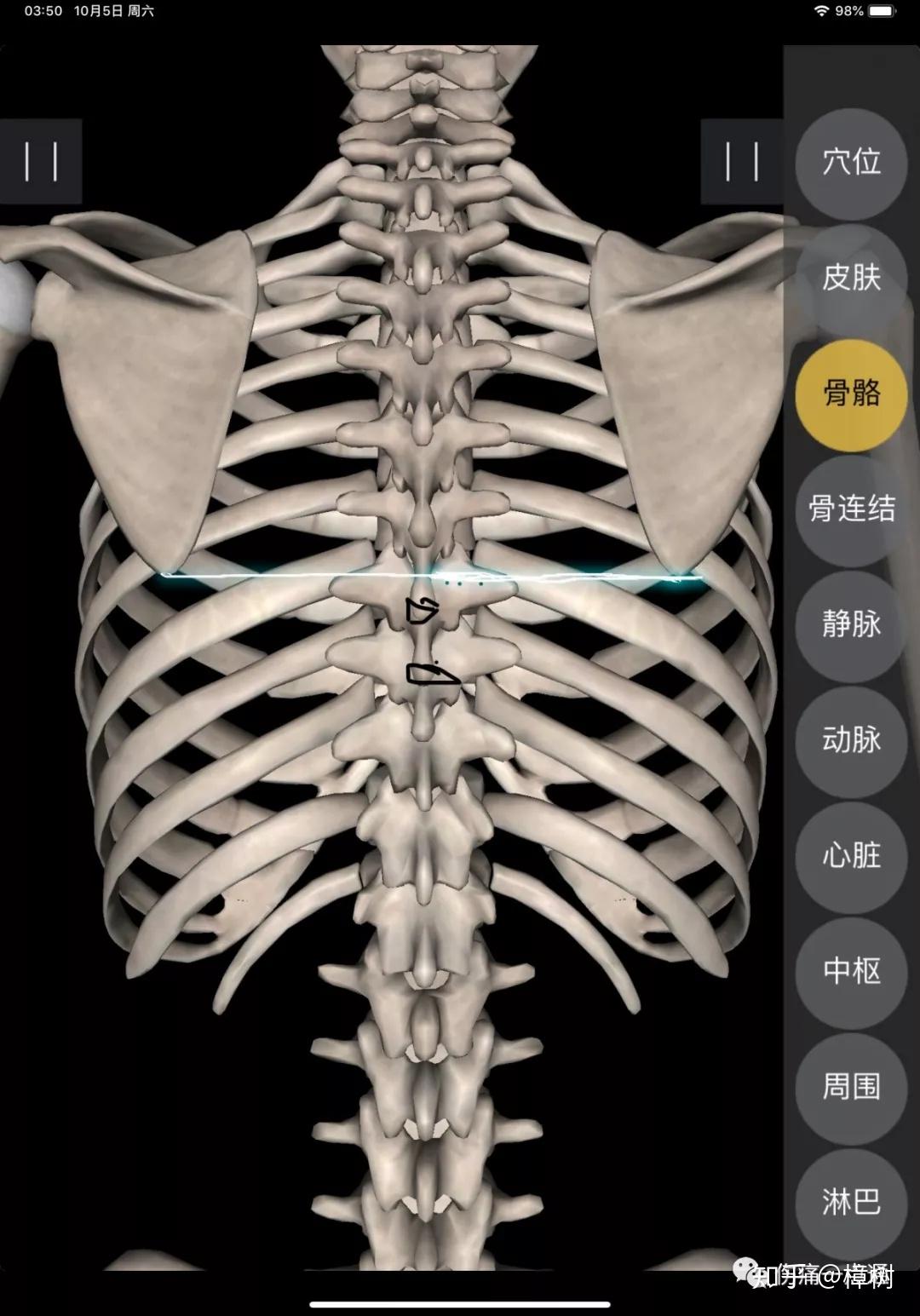 胸椎棘突的位置图片图片
