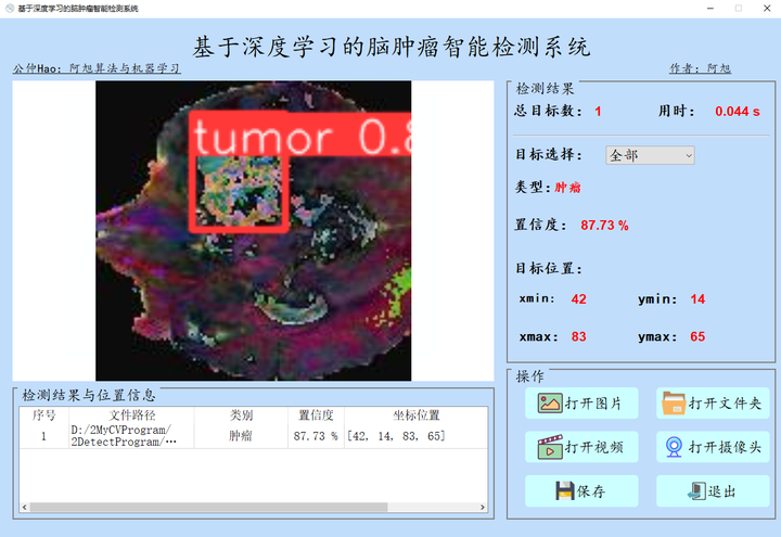 基于YOLOv8深度学习的脑肿瘤智能检测系统【python源码+Pyqt5界面+数据