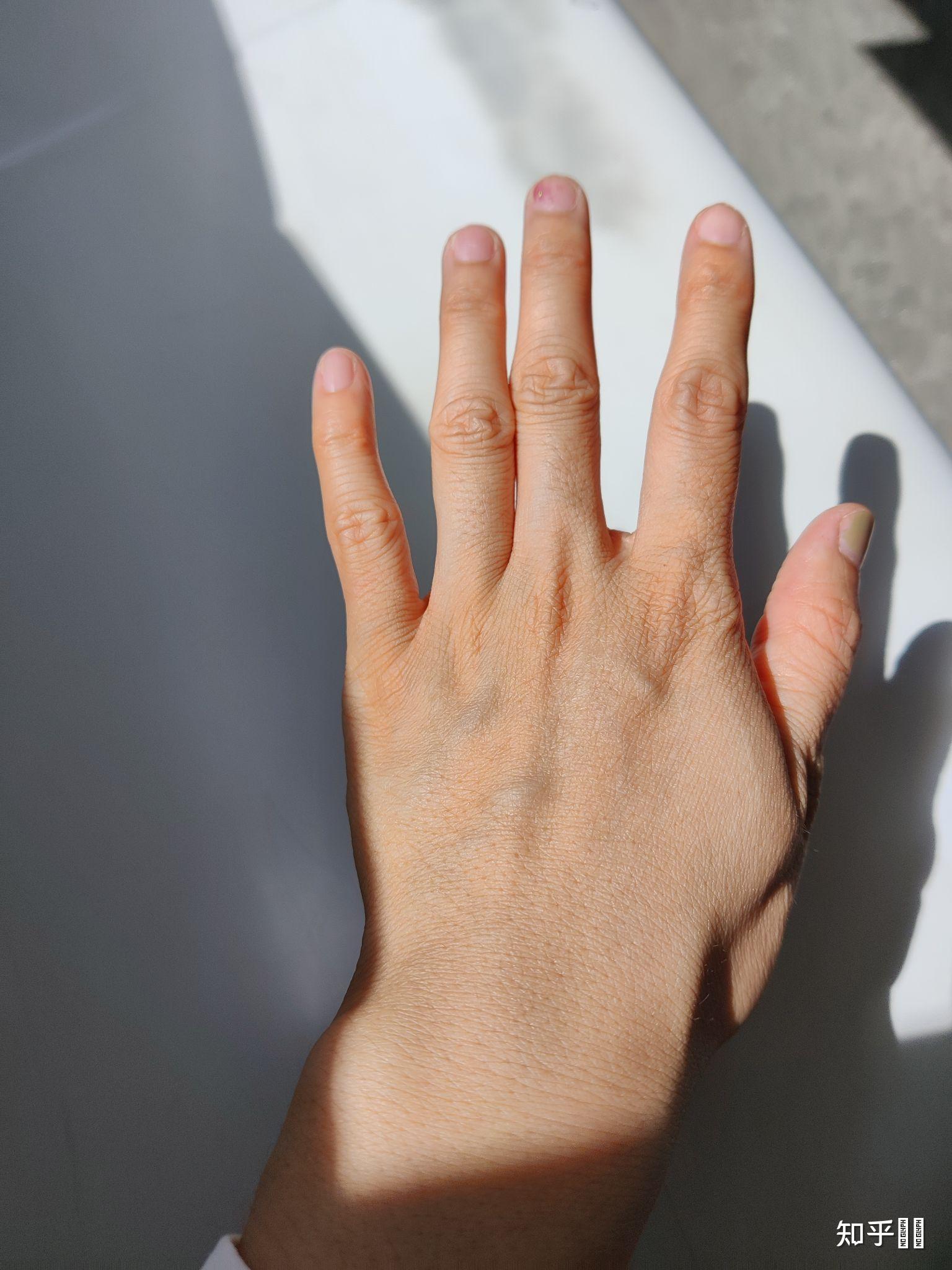 手掌很硬很粗糙怎么办,已经勤擦手霜也有做手膜,还是干涩硬粗糙,感觉