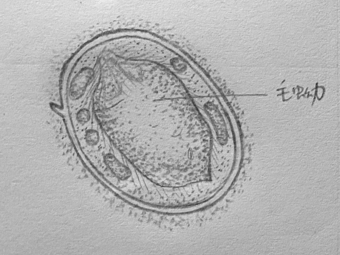 期末考核：人体寄生虫虫卵（附手绘图） - 知乎