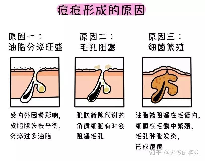 这是闭口还是毛周角化? - 知乎