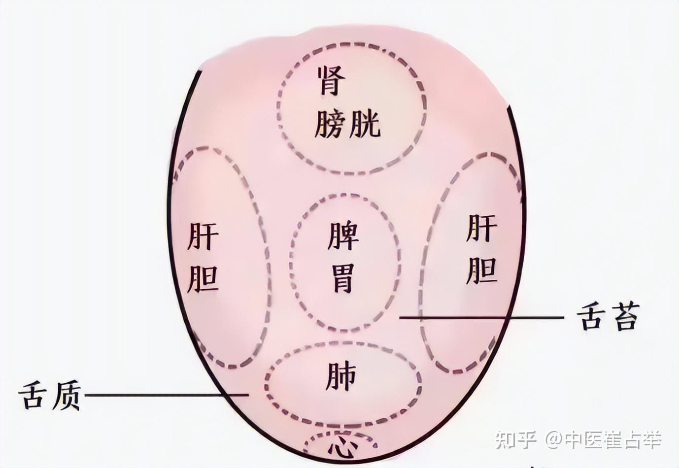 舌头有裂纹,可能不是脾虚,而是这里的问题,快来对照一下 - 知乎
