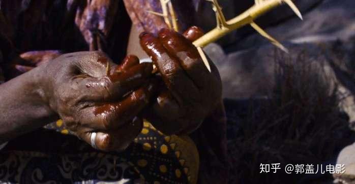 而更可怕的是,因为非洲等贫苦国家没有多么好的医疗条件进行"割礼"的