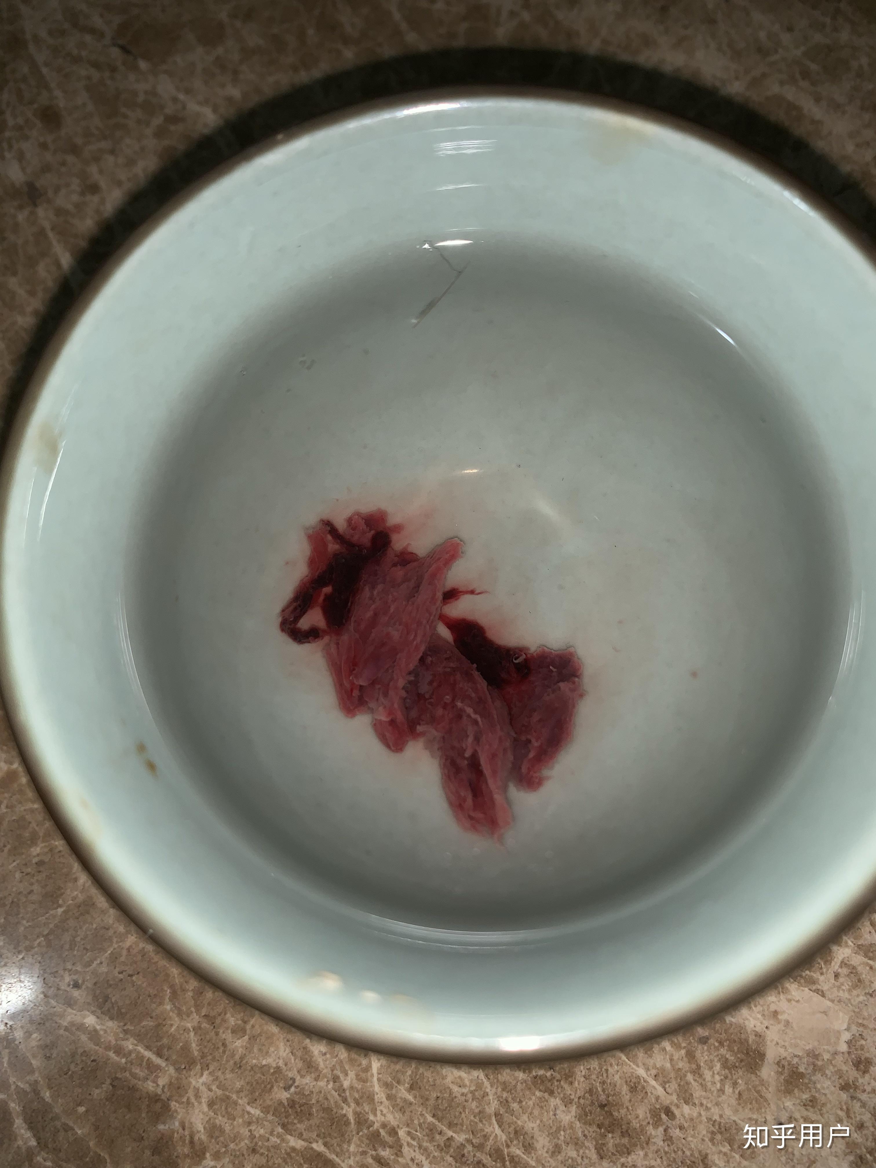 月经例假你们来的时候只是血吗因为我有时候有血块