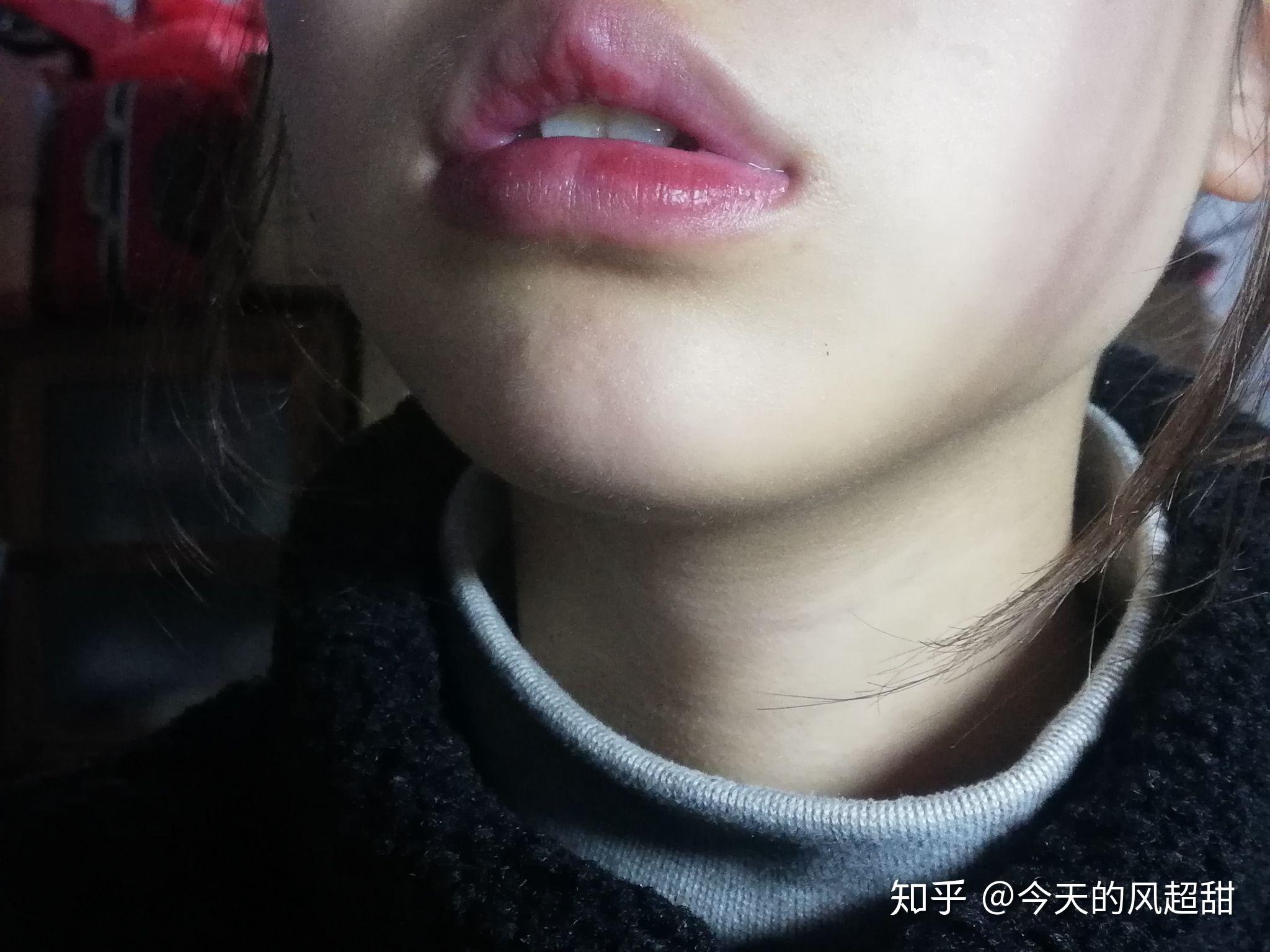 嘴型不好看会影响颜值吗