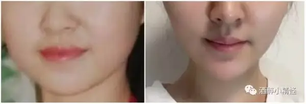 吸引 後悔 脂肪
