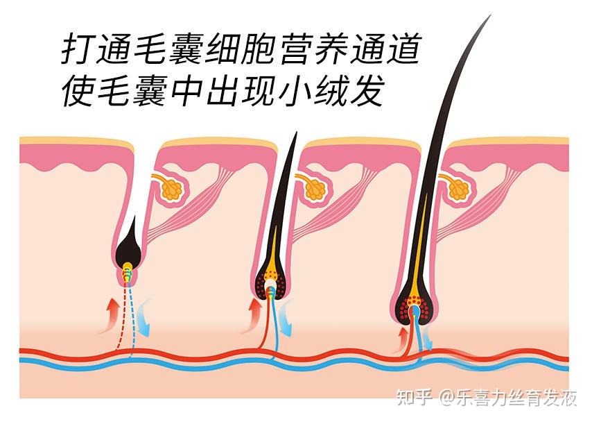 乐喜力丝是怎么生发的看完可以放心用