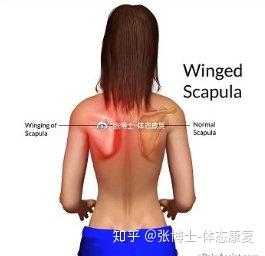体态矫正 不良体态对肩胛骨的影响 处理肩胛骨内侧痛的14个步骤 知乎