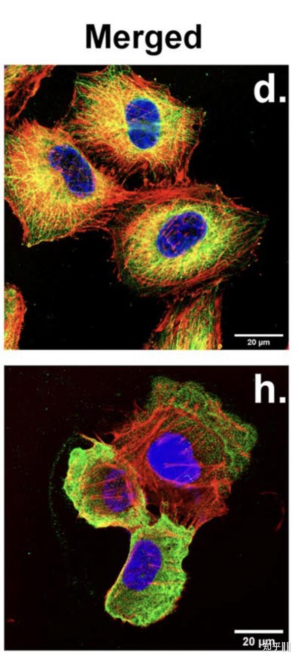 光学显微镜能否观察特殊处理后细胞的细胞骨架? - 知乎