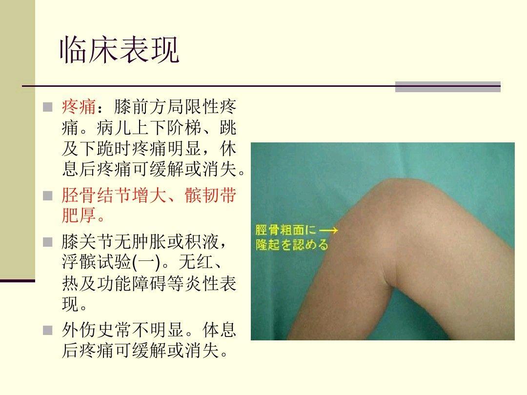 右腿膝盖下长了个块影不影响当兵的体检啊好像是什么胫骨结节骨骺炎