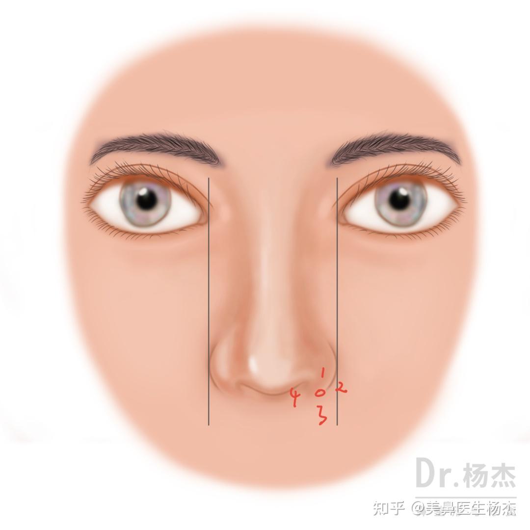 鼻的影像解剖_医学界-助力医生临床决策和职业成长