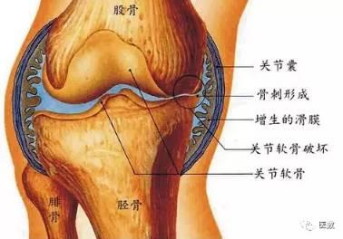 膝關節滑膜治療方法你知道炎幾種