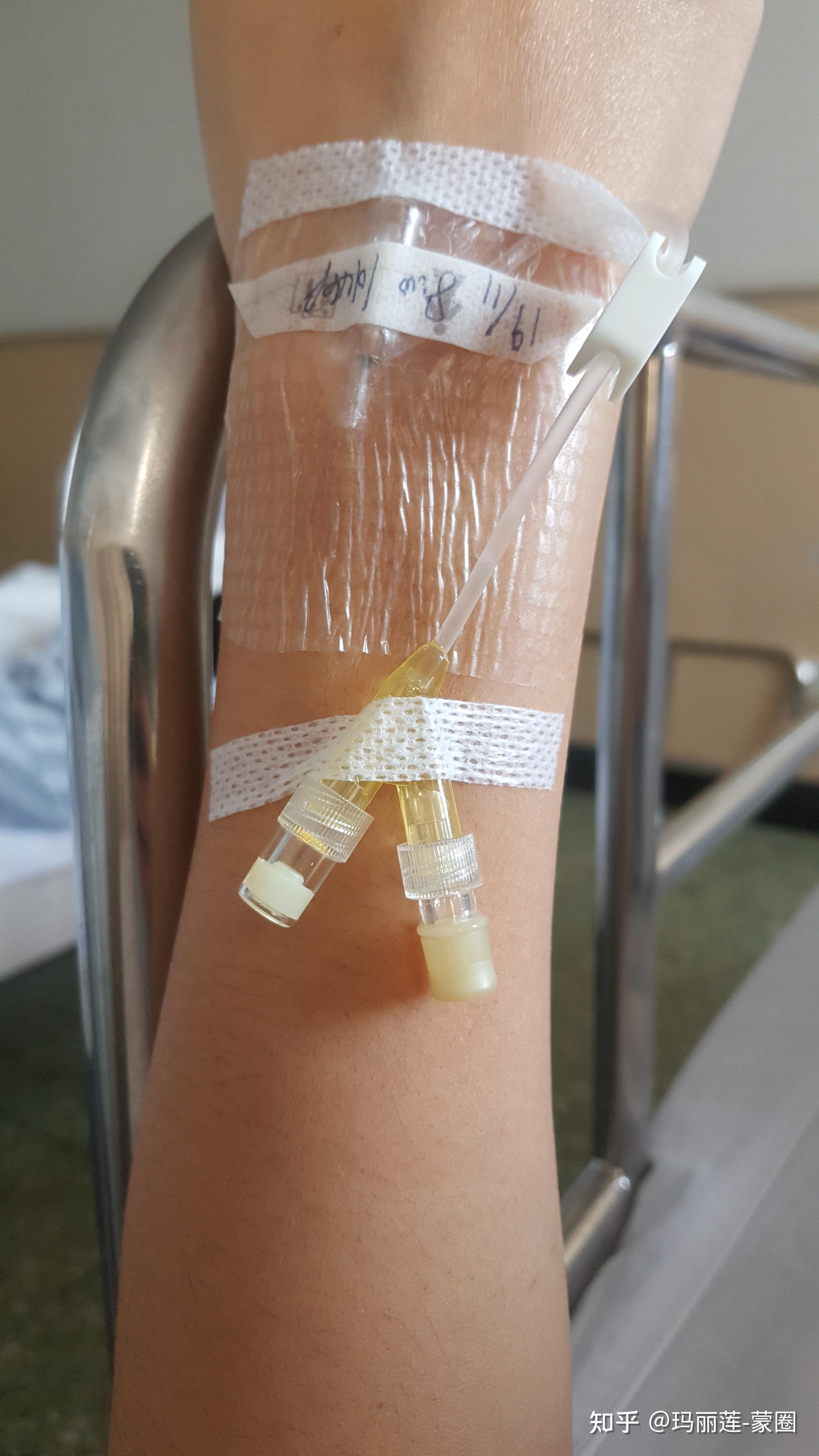 就要打开引流管开关引流体内的某种废掉的液体 之后是6小时?