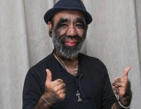 毛哥于震寰全世界体毛最多的人是如何在歧视中歌唱精彩人生