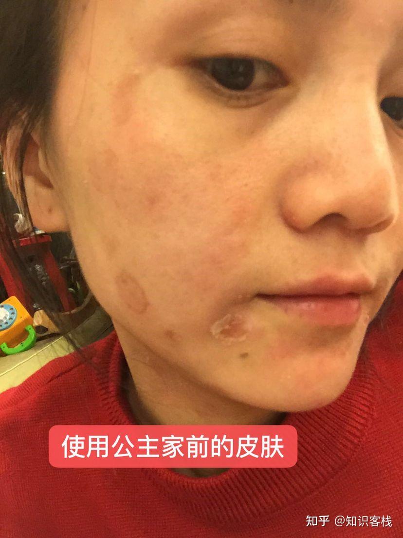 【公主家仟佰宠,选择及上瘾的护肤品】 - 知乎