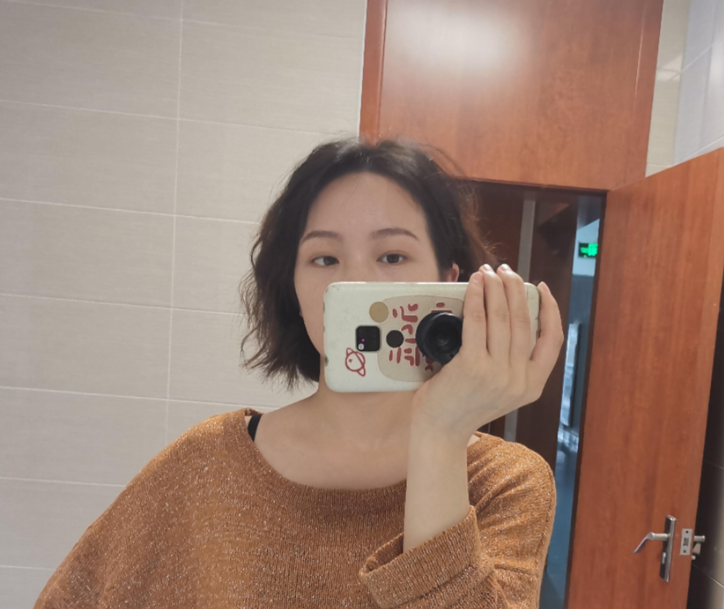鼻骨骨折医生不建议手术 但是鼻子有凸起怎么办 手术花费多少 手术需要人陪吗 知乎