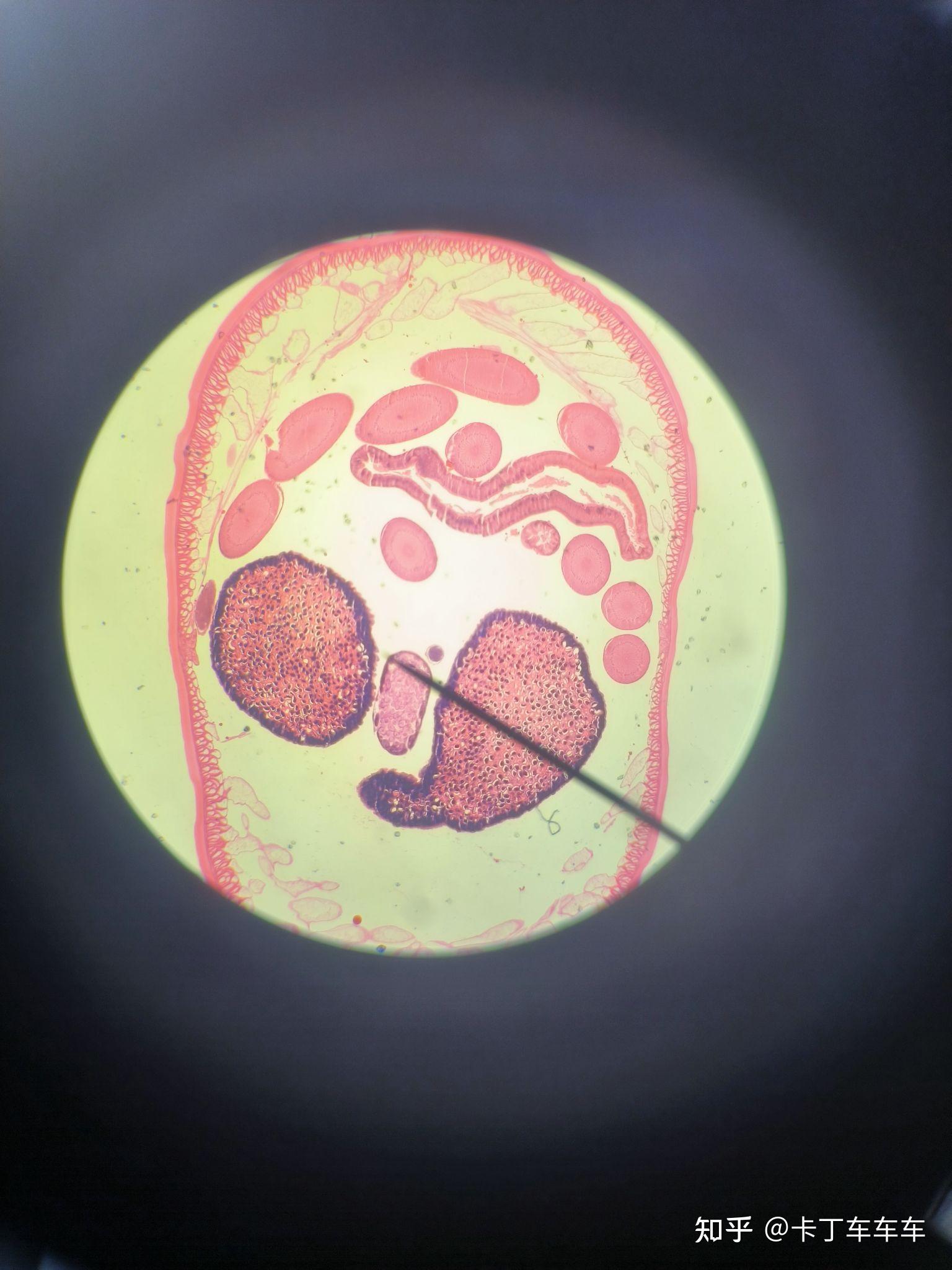 绘制雌雄蛔虫横切图.