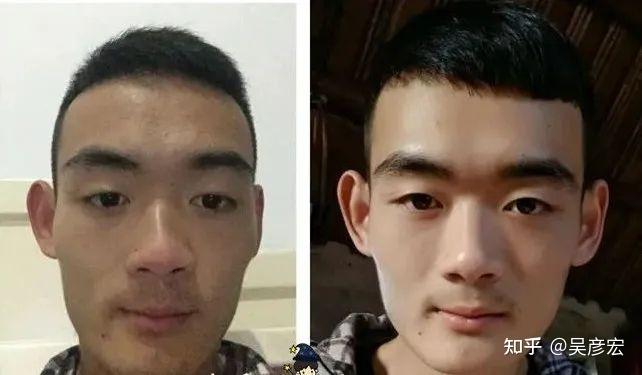 戒掉sy后年轻好多没有对比就没有伤害图片对比