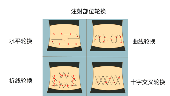 脐周注射的位置标准图图片