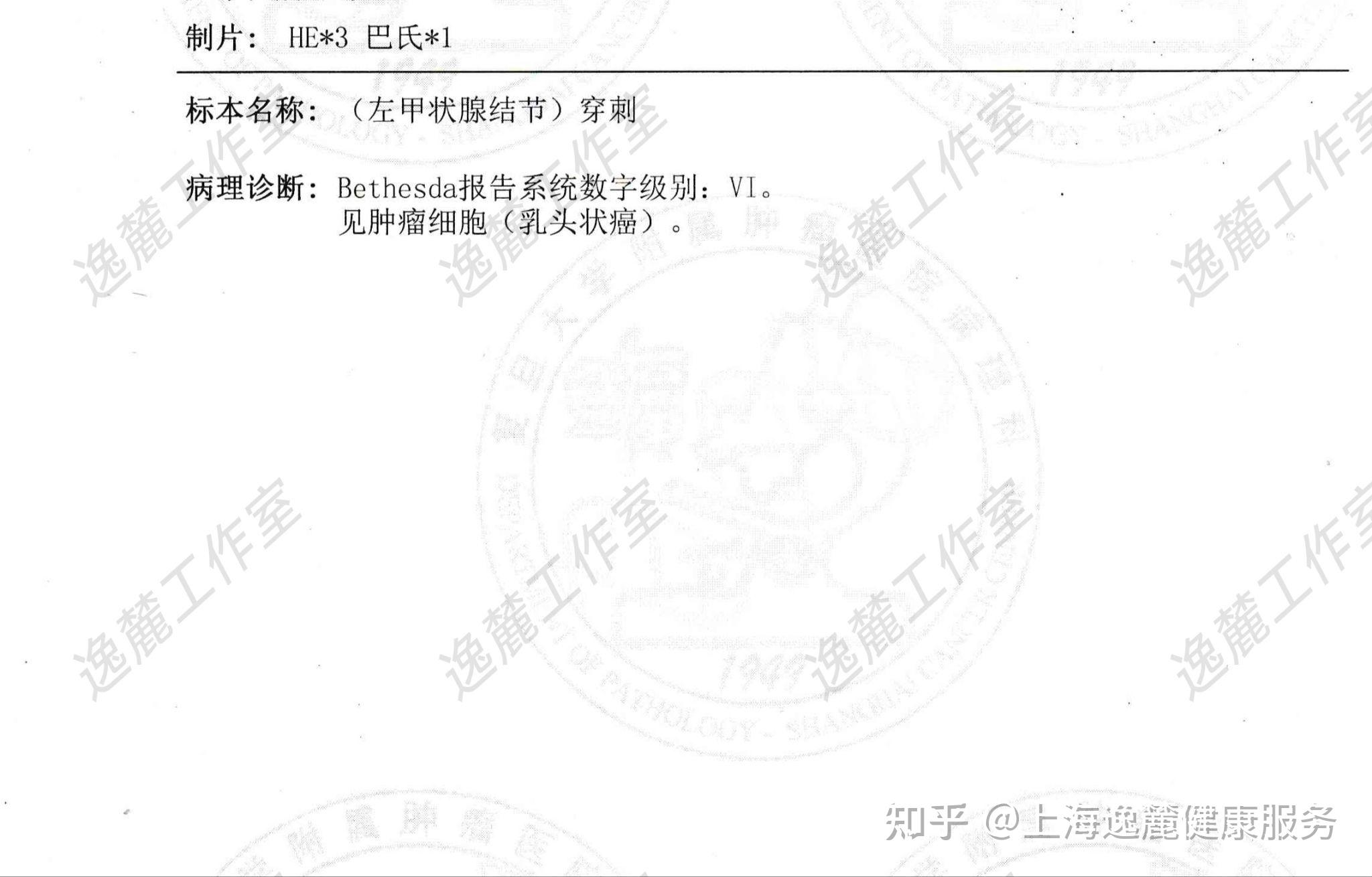北京大学肿瘤医院全程代诊含挂号隐私严格保护，服务安全放心的简单介绍