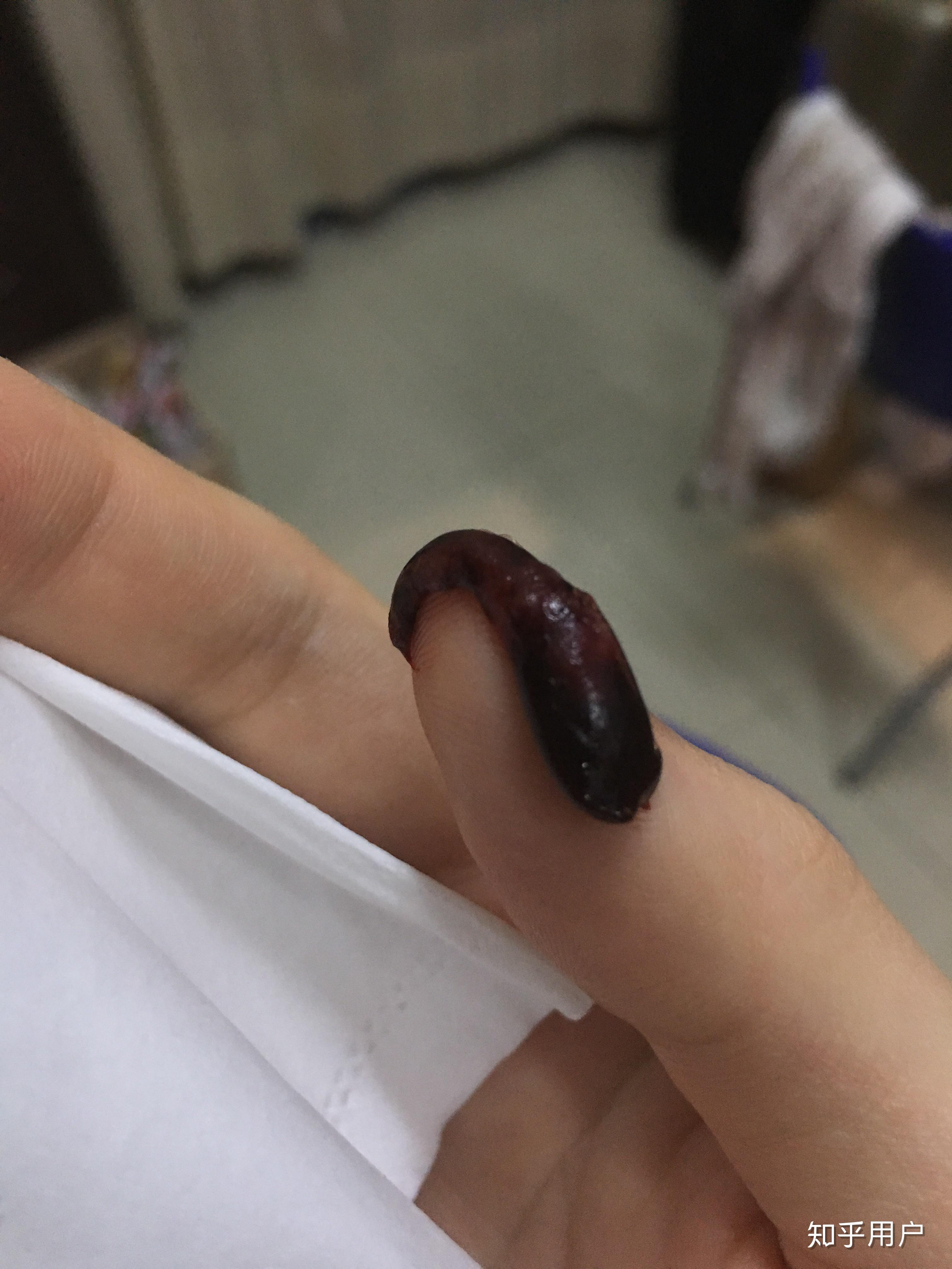 来月经的时候里面好像有肉块一样的东西流出来是什么啊?