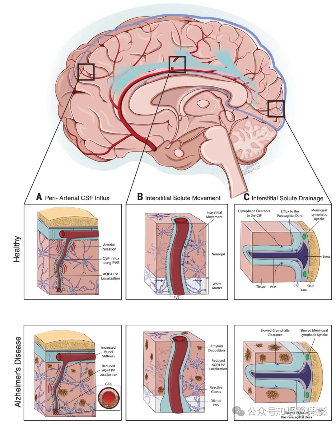 Science：类淋巴系统功能障碍在阿尔茨海默病中的作用- 知乎