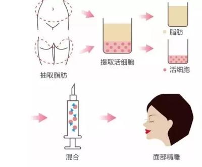 v2-cc7ea4a1ecacc7044f062d4ec609c3b1_1440w.jpg?source=172ae18b