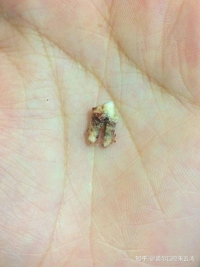 朋友洗个牙花2000发截图给我我说你花少了