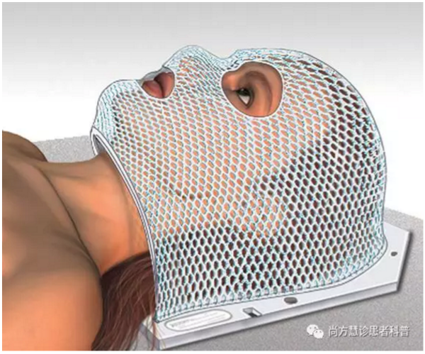 头部放疗的患者可能需要一个面罩