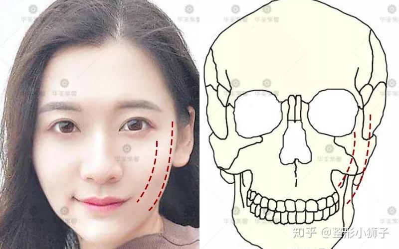 如何判断一个人的颧骨是高还是低