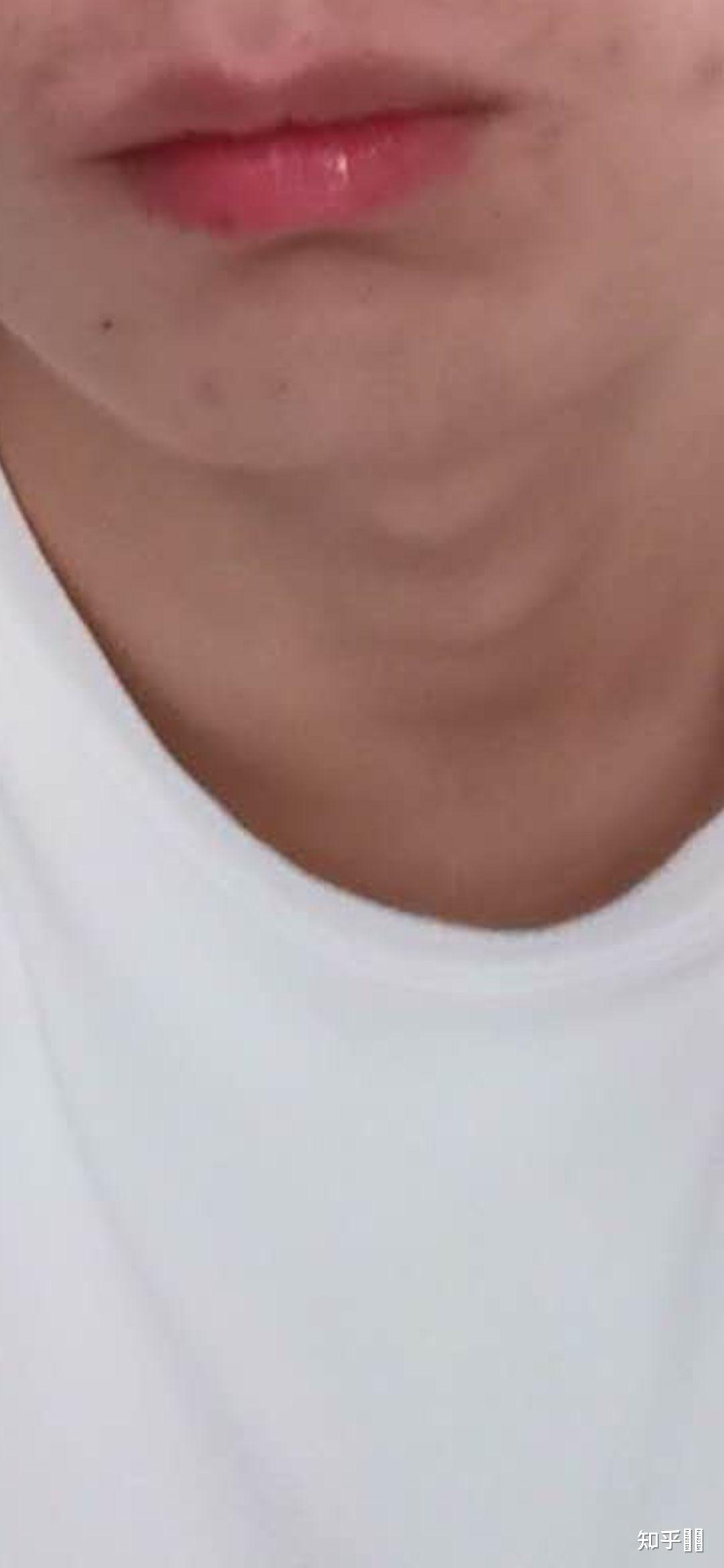 男生嘴长得好看是怎样一种体验