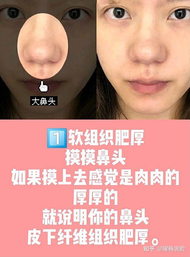 如何拯救大鼻头?