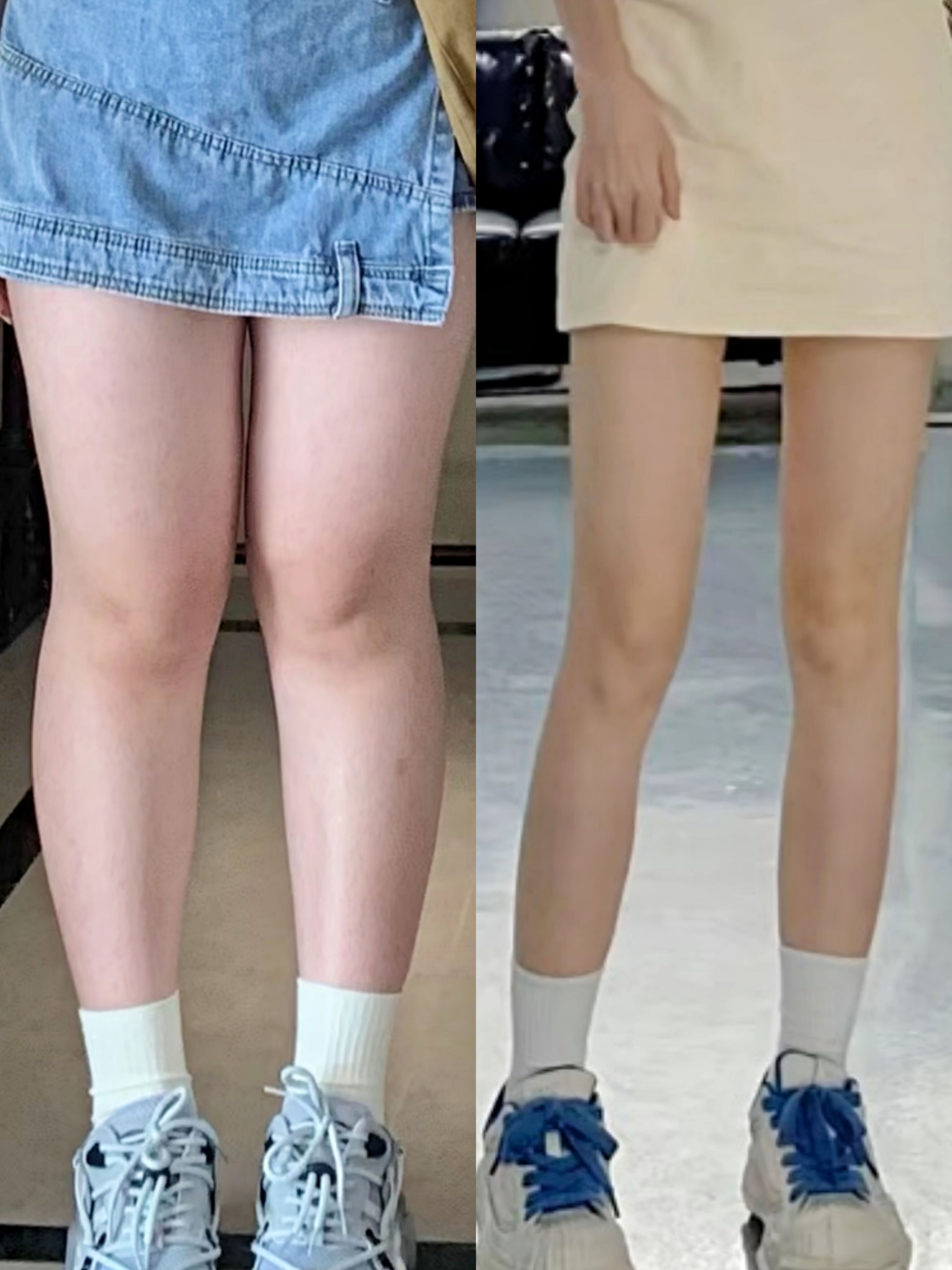瘦腿前后对比照片图片