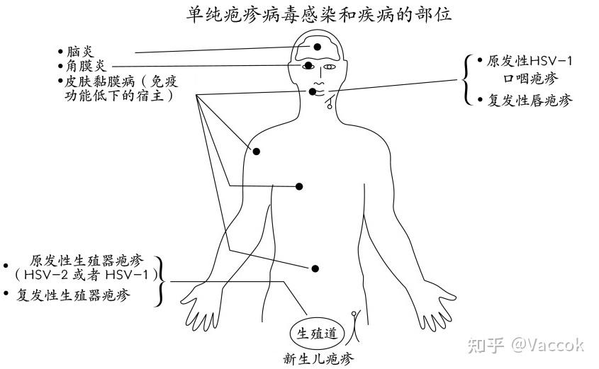 克尤瑞坦科普馆 单纯疱疹病毒