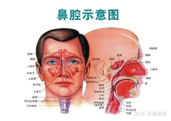 为啥鼻窦炎一到冬天就发作？说说鼻窦炎那些事！ - 知乎