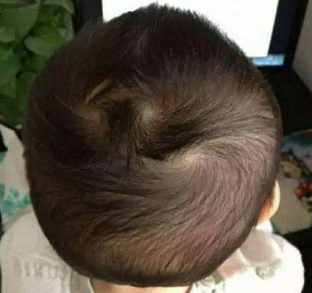 “一旋好,二旋坏?”孩子头顶有两个旋,背后到底有什么含义 - 知乎