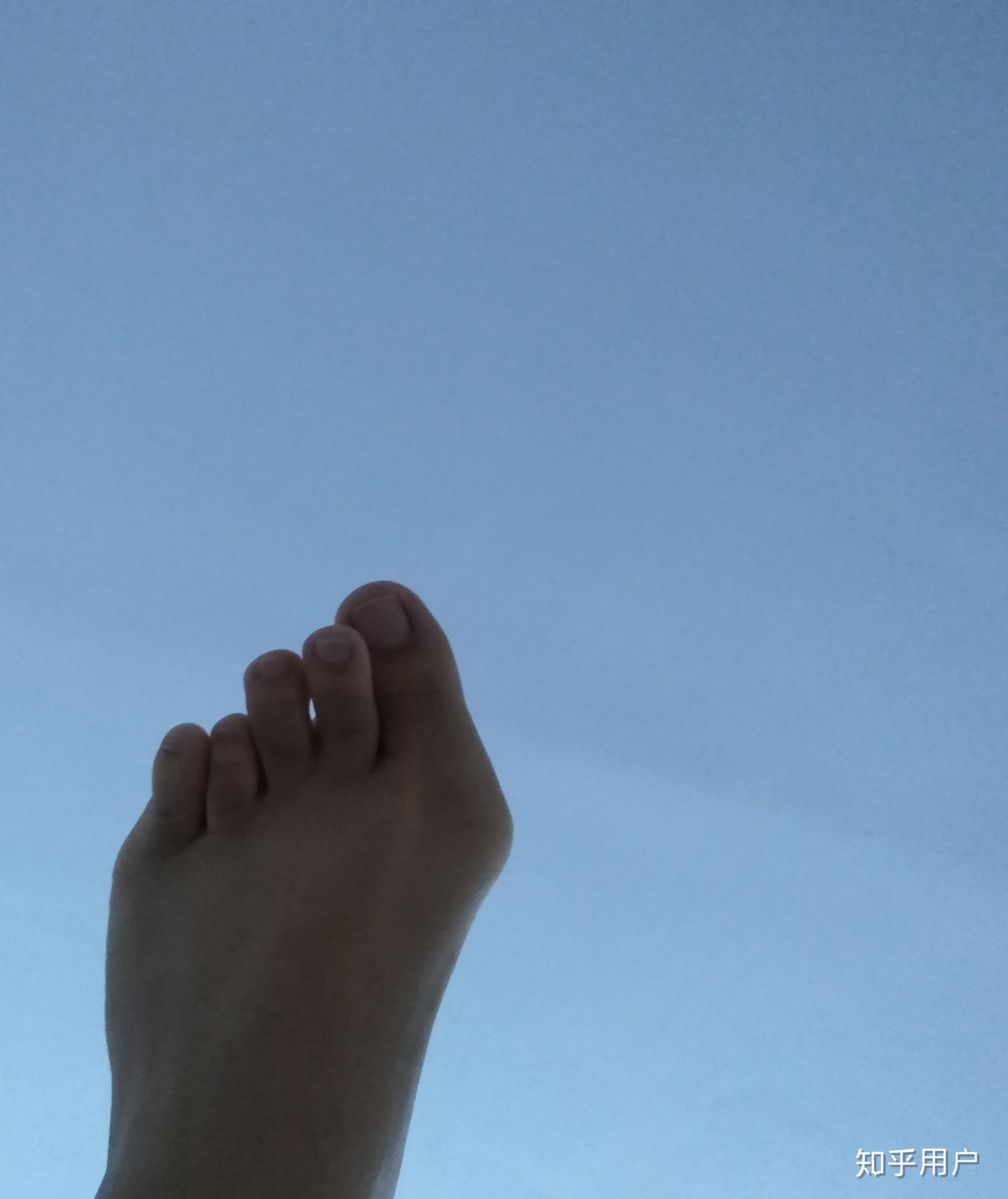 女生脚丑是种什么样的体验? - 知乎