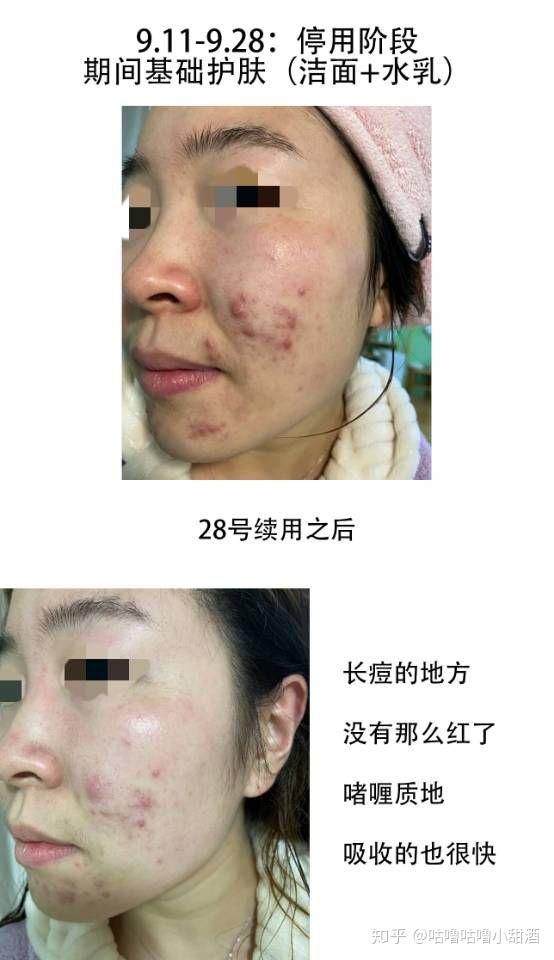 v2-cd7c2aac42a45dbf7b520b534b136b58_r.jpg