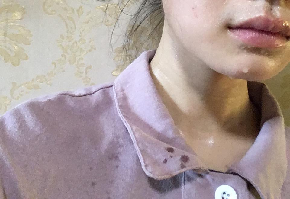 出汗会让皮肤变好那么运动出汗和热出汗一样的程度达到的效果一样吗