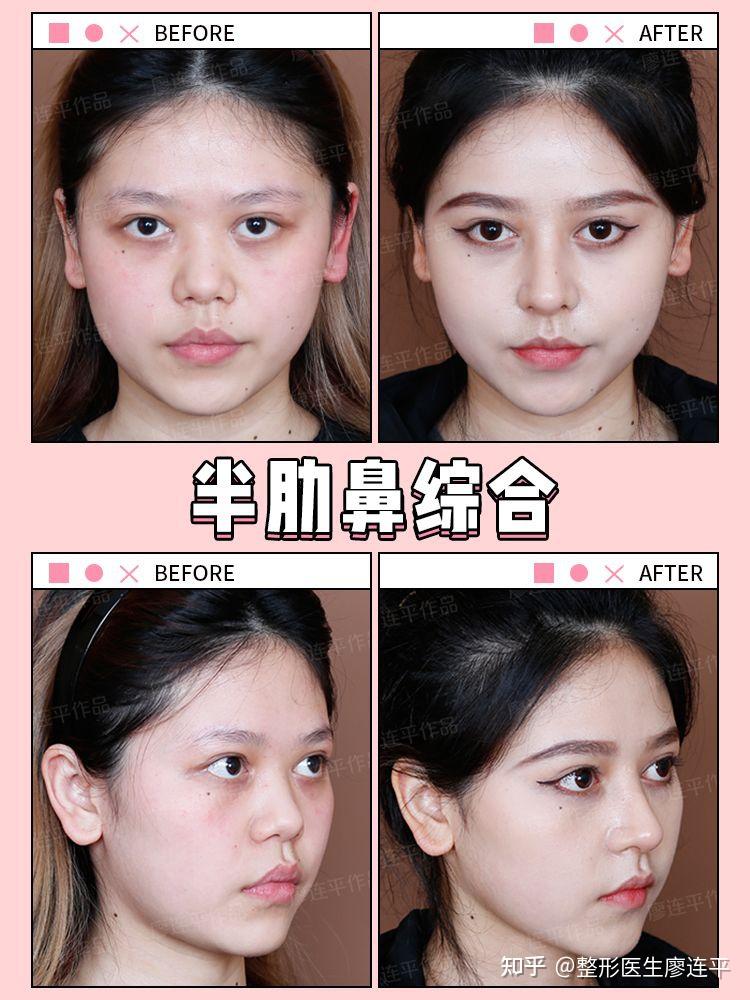 扁平脸如何实现颜值进阶? - 知乎