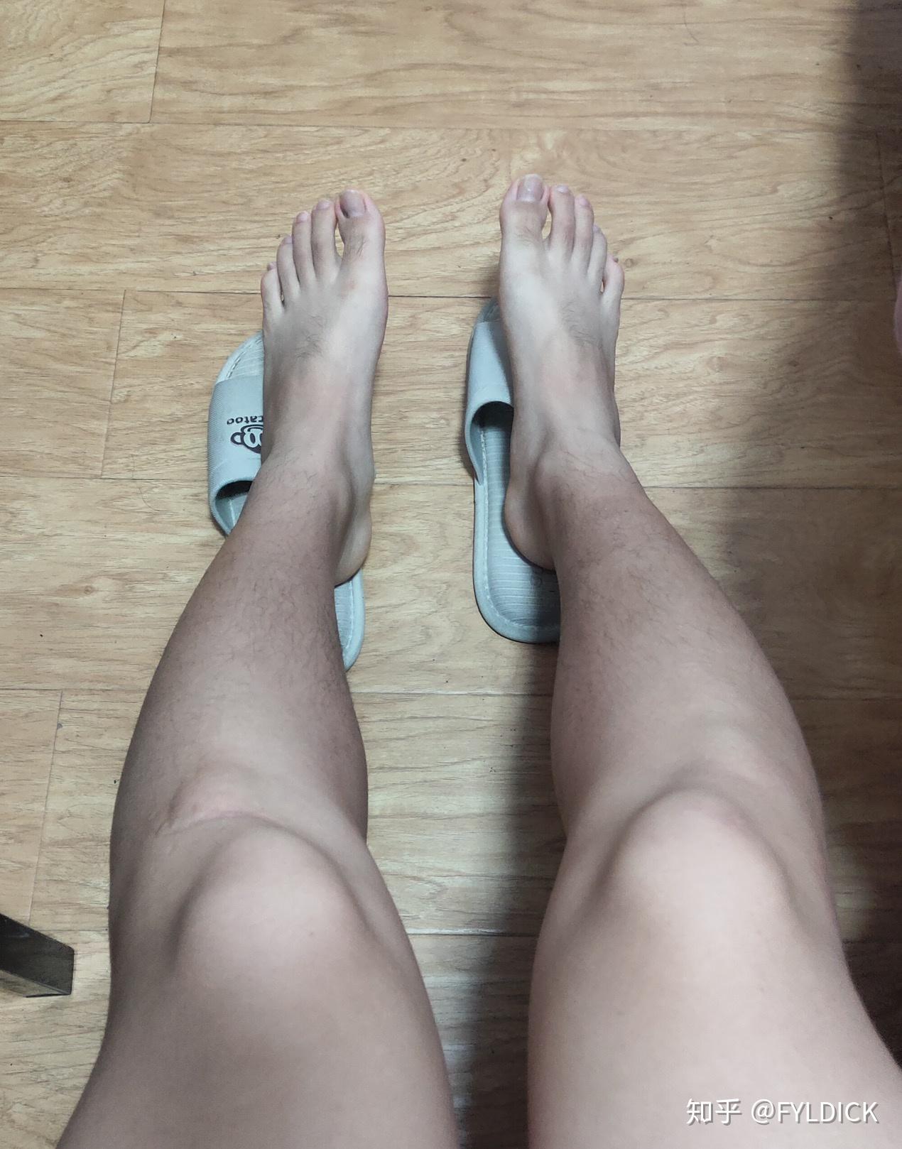 请问我是否患有膝内翻或者膝外翻呢能否治疗呢