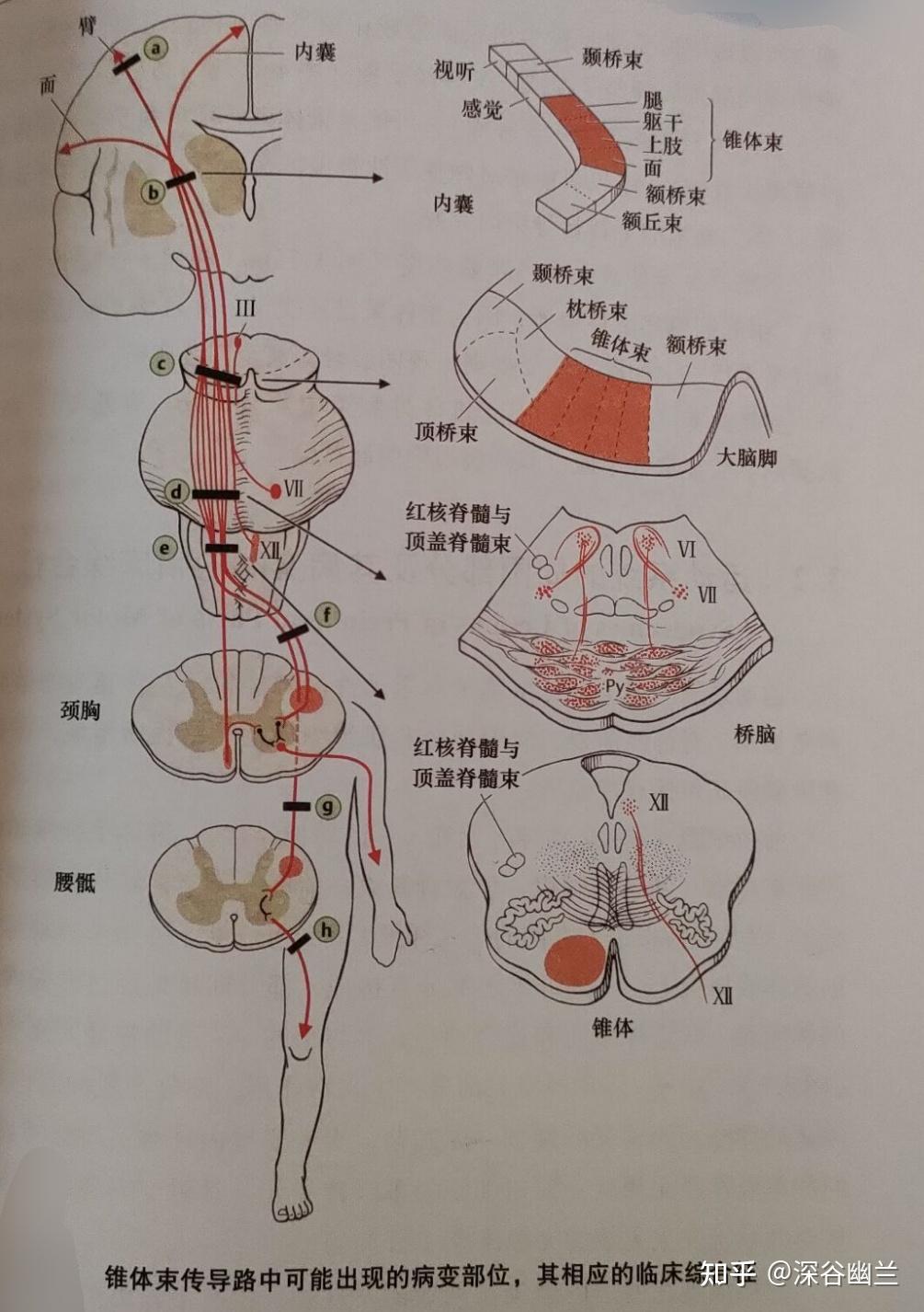 中枢性运动系统病变的定位分类 - 知乎
