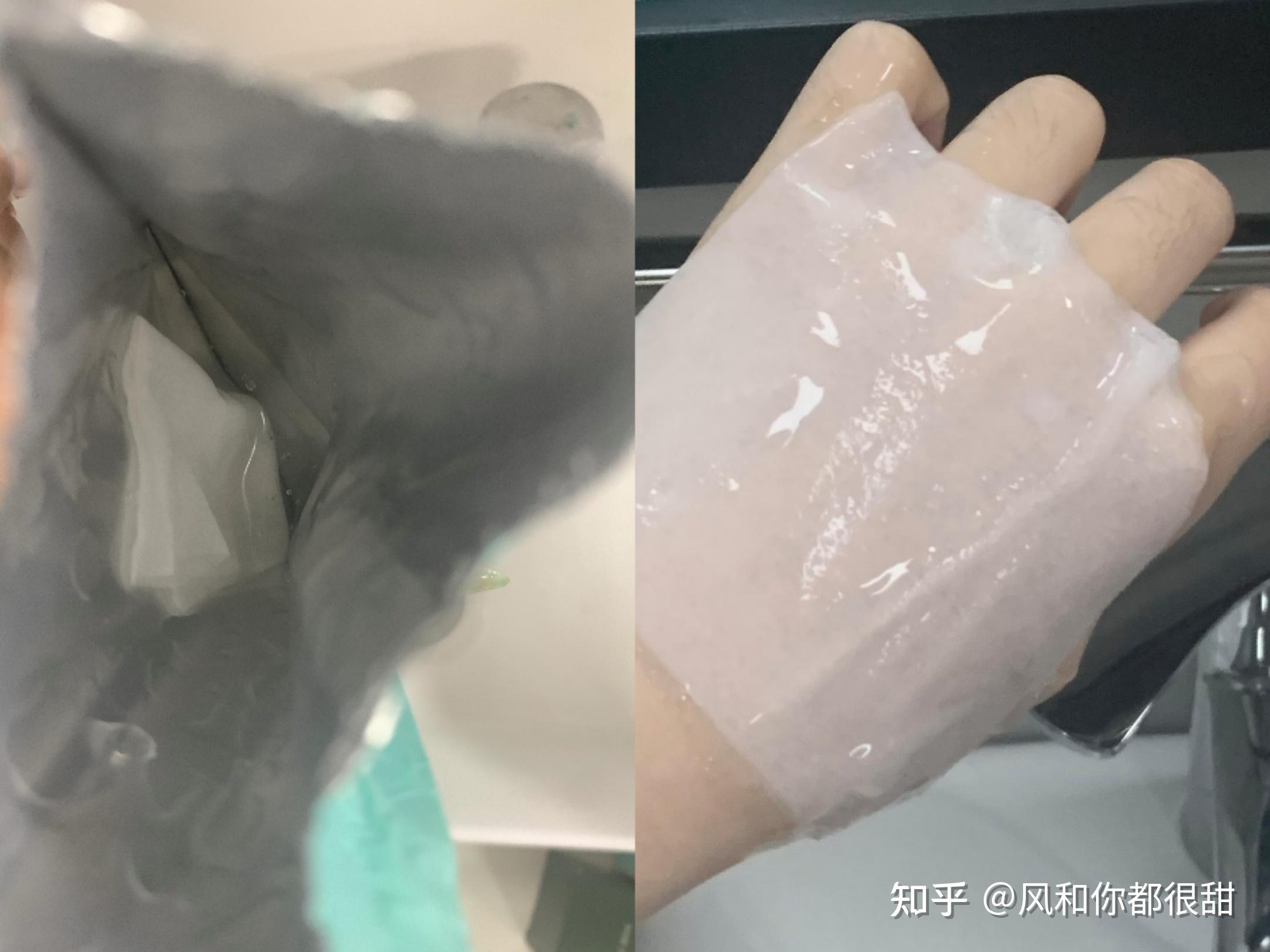 玻尿酸原液能治疗鸡皮肤吗(玻尿酸原液能治疗鸡皮肤吗图片)