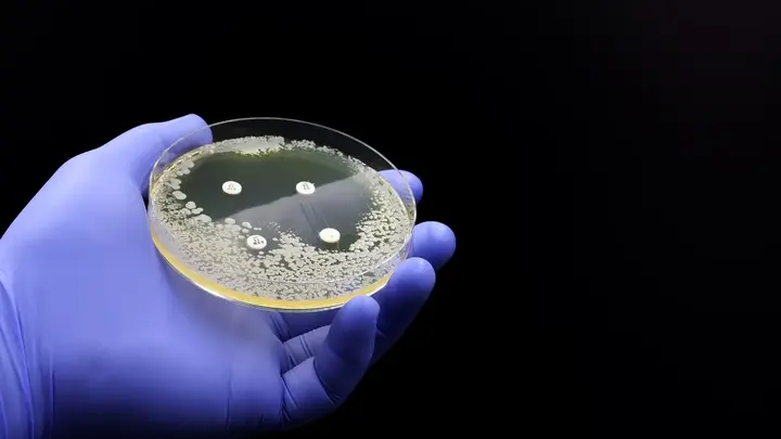 细菌转化和转化实验方案 - 知乎