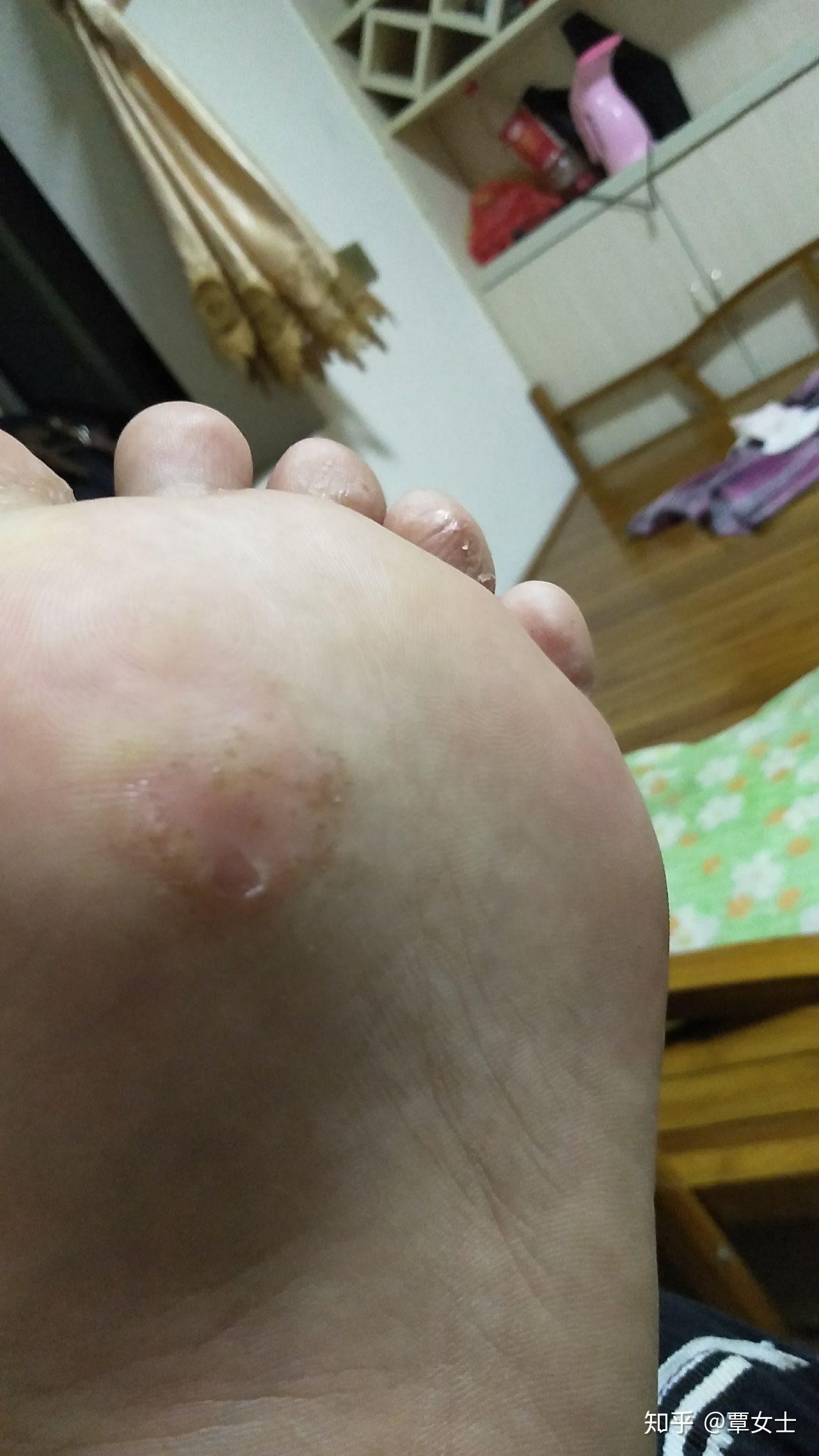 还几年不见好?不知是什么病?如何治好?